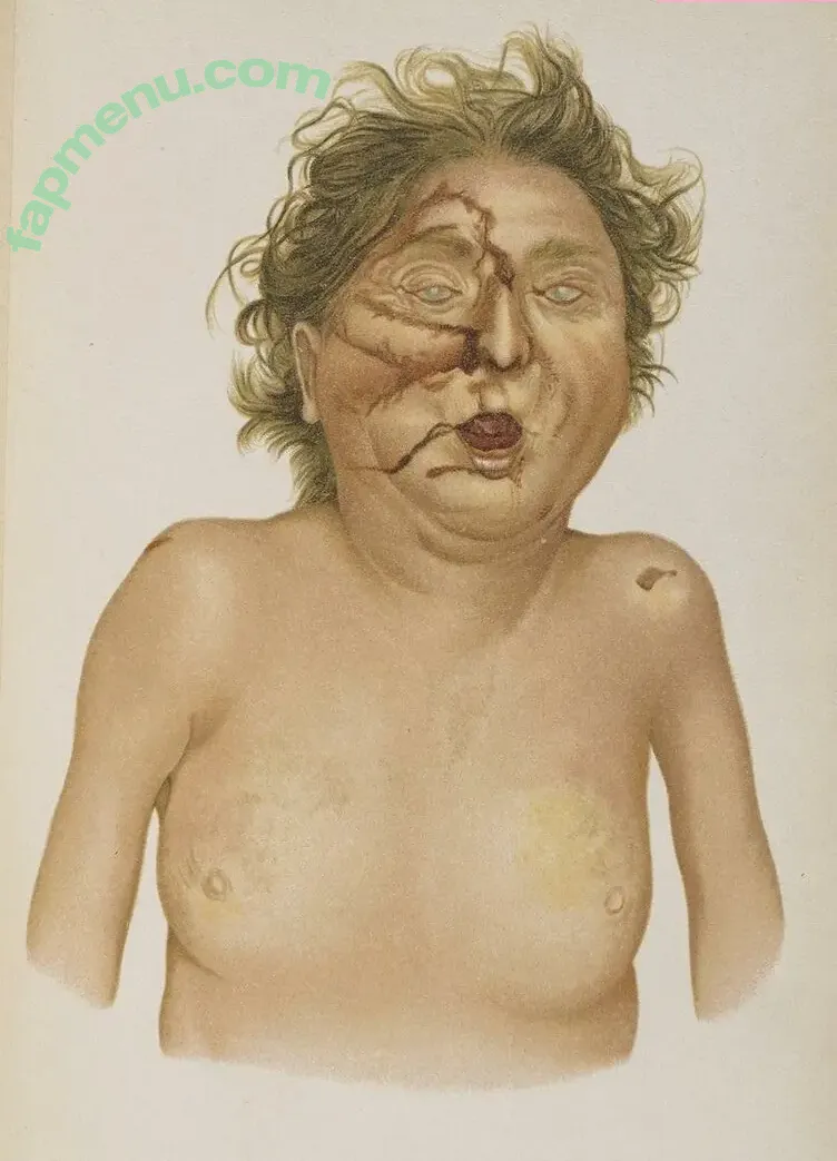 forensic nude photo #0001 (forensic)