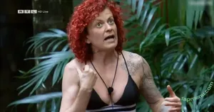 Ich bin ein Star – Holt mich hier raus! / ichbineinstar.rtl nude photo #0091