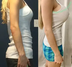 Katelyn Keplar / cpelletiere / katelynkeplar / katiekeplar nude photo #0111