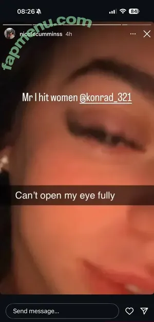 Nicolephathole / nicolecumminss nude photo #0007