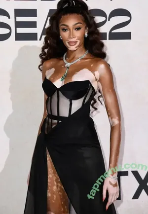 Winnie Harlow / winnieharlow nude photo #0535