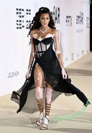 Winnie Harlow / winnieharlow nude photo #0540