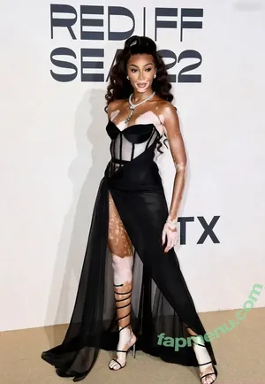 Winnie Harlow / winnieharlow nude photo #0544