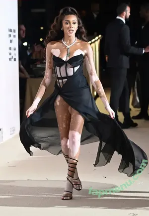 Winnie Harlow / winnieharlow nude photo #0548
