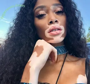 Winnie Harlow / winnieharlow nude photo #0551