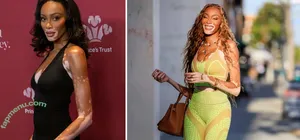 Winnie Harlow / winnieharlow nude photo #0556