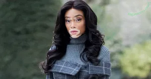Winnie Harlow / winnieharlow nude photo #0558