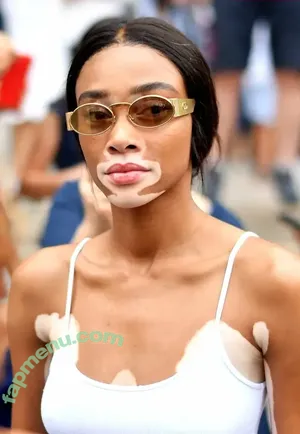 Winnie Harlow / winnieharlow nude photo #0559