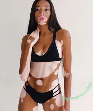 Winnie Harlow / winnieharlow nude photo #0561