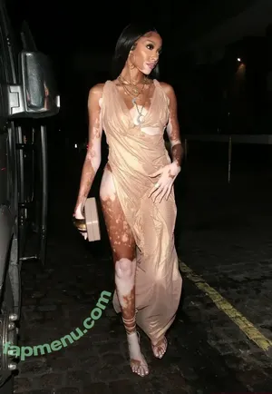 Winnie Harlow / winnieharlow nude photo #0562