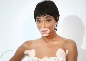 Winnie Harlow / winnieharlow nude photo #0564