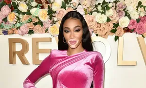 Winnie Harlow / winnieharlow nude photo #0575
