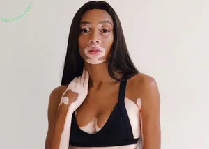 Winnie Harlow / winnieharlow nude photo #0581