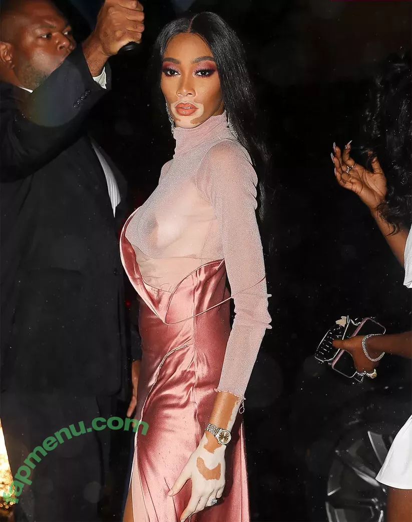 Winnie Harlow nude photo #0190 (winnieharlow)