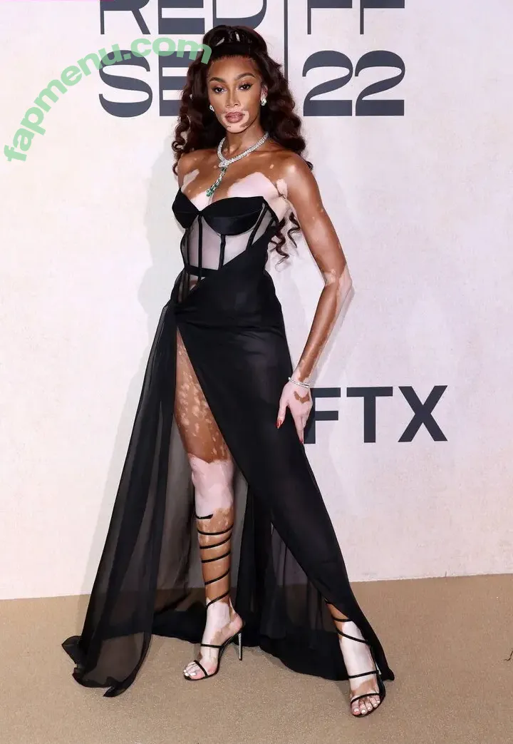 Winnie Harlow nude photo #0546 (winnieharlow)