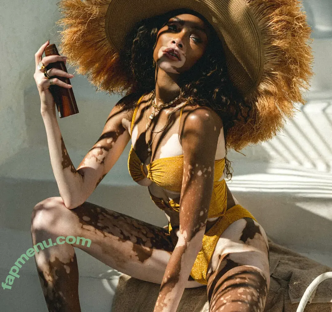 Winnie Harlow nude photo #0574 (winnieharlow)