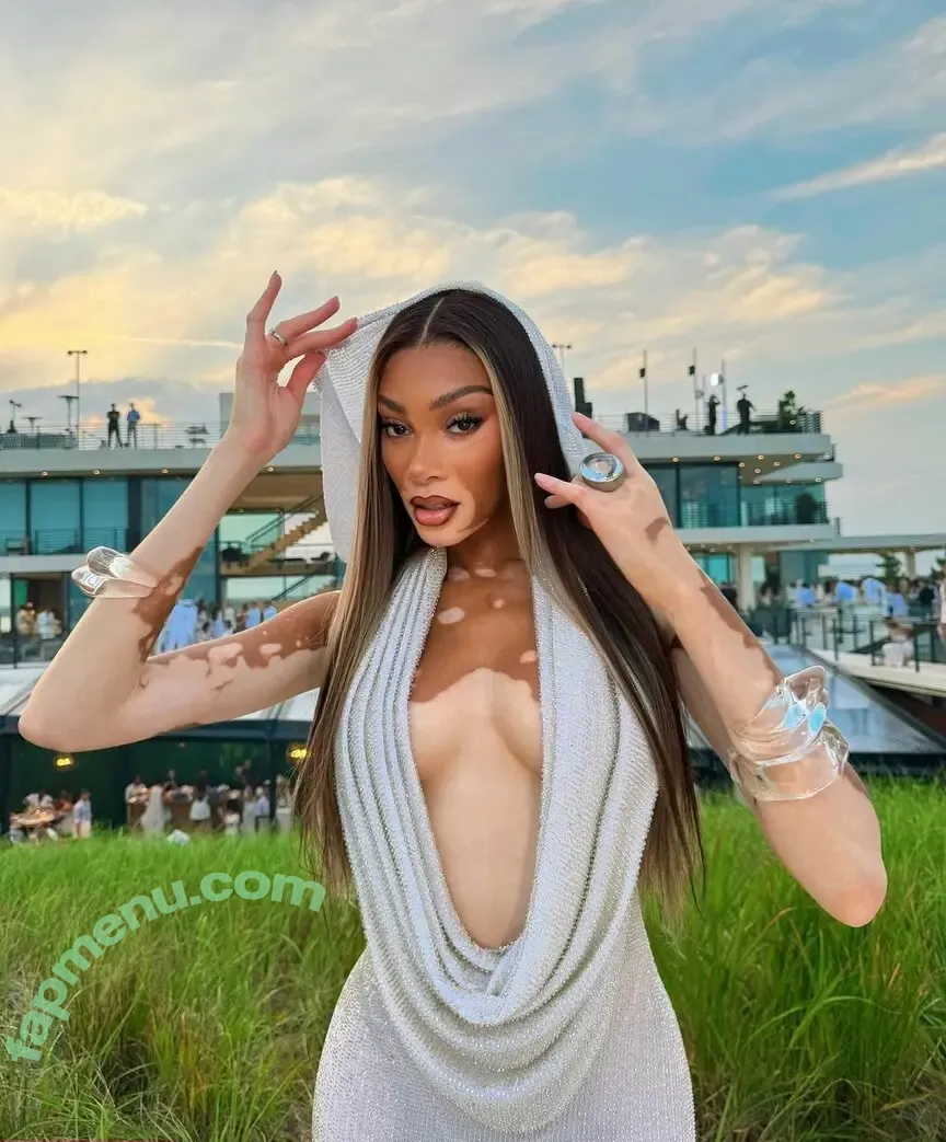 Winnie Harlow nude photo #0578 (winnieharlow)