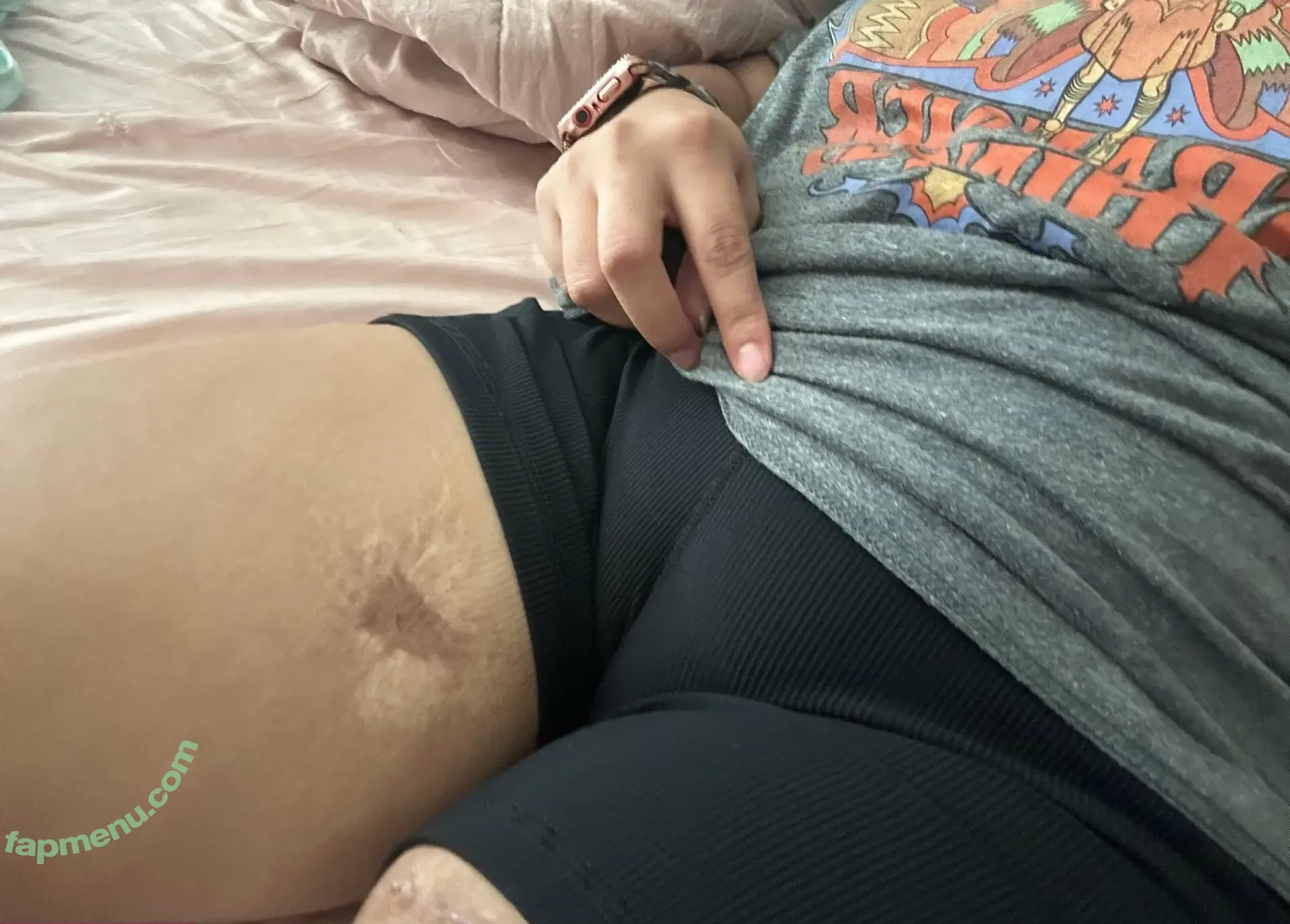 amputeefreak nude photo #0022 (slimgini)