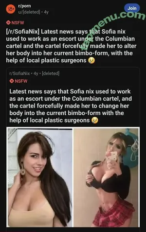 Before and After : Pornstar Boobjobs / _celebrities_before_after_ nude photo #0022