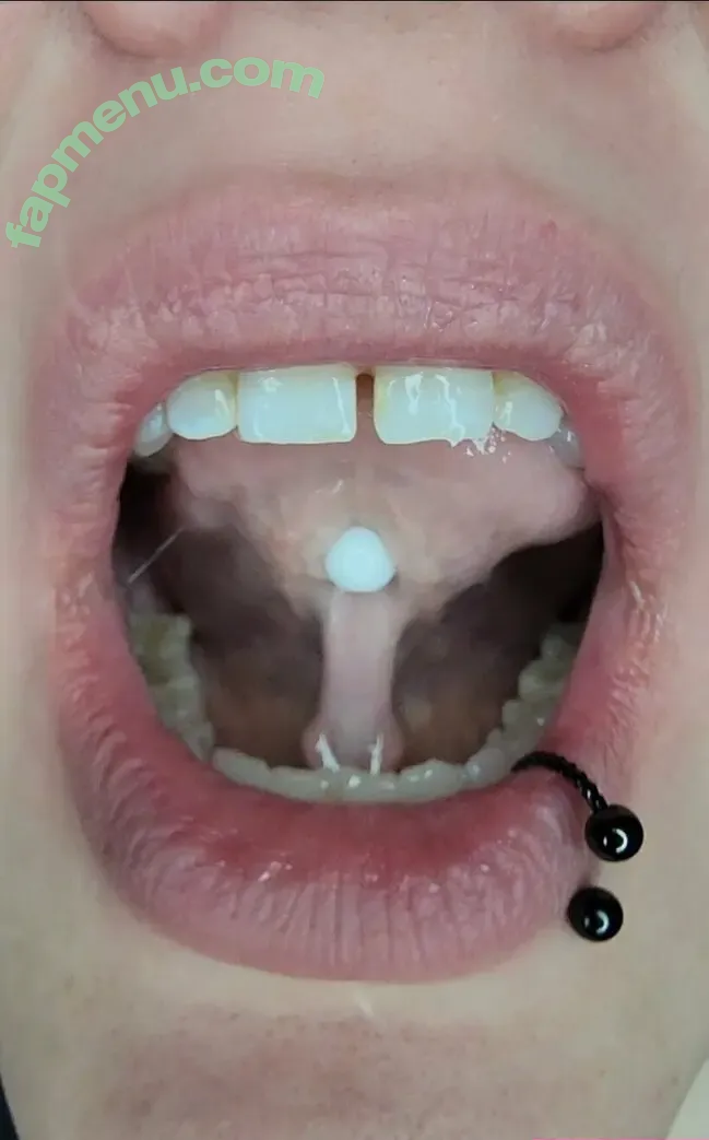 blemishedbeauty nude photo #0145 (blemishedbeauty)