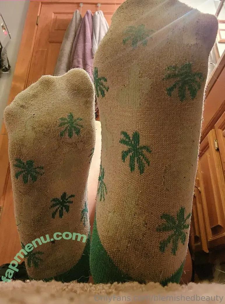 blemishedbeauty nude photo #0150 (blemishedbeauty)