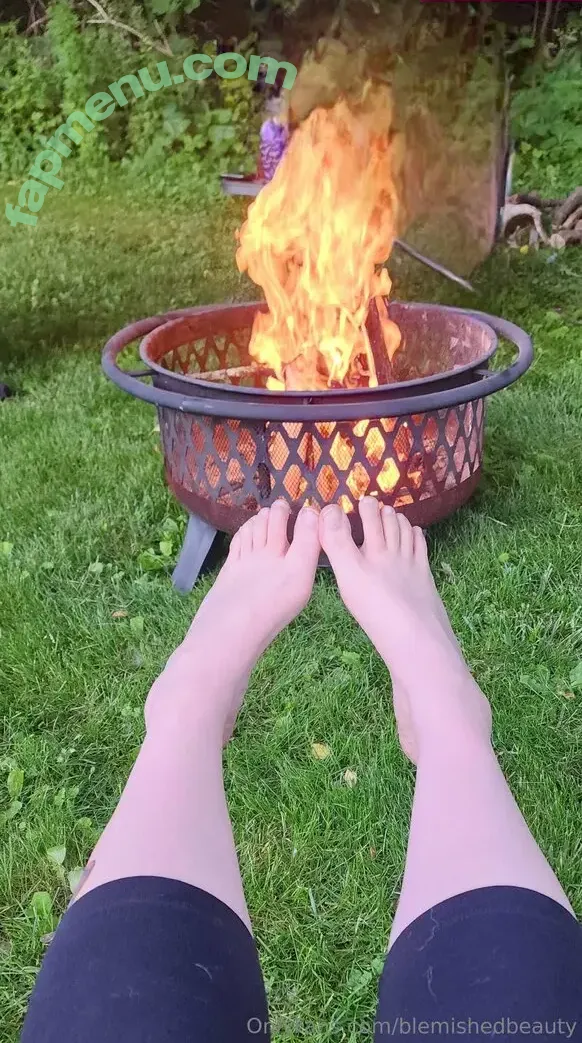 blemishedbeauty nude photo #0151 (blemishedbeauty)