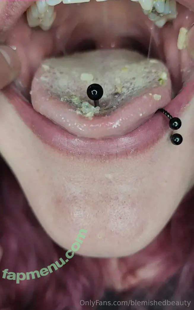 blemishedbeauty nude photo #0156 (blemishedbeauty)