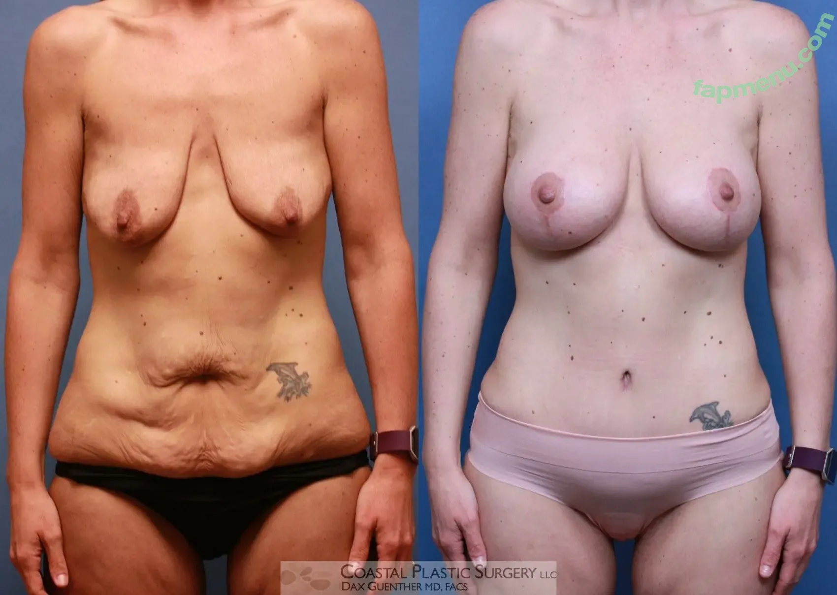 Boston Mom nude photo #0005 (Boston Mom)