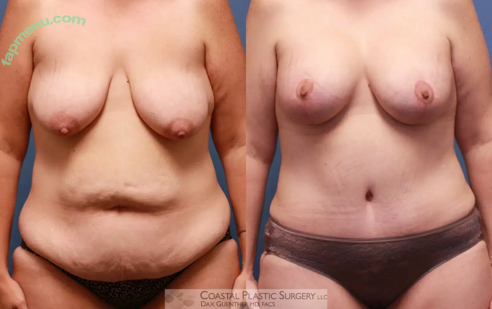 Boston Mom nude photo #0008 (Boston Mom)