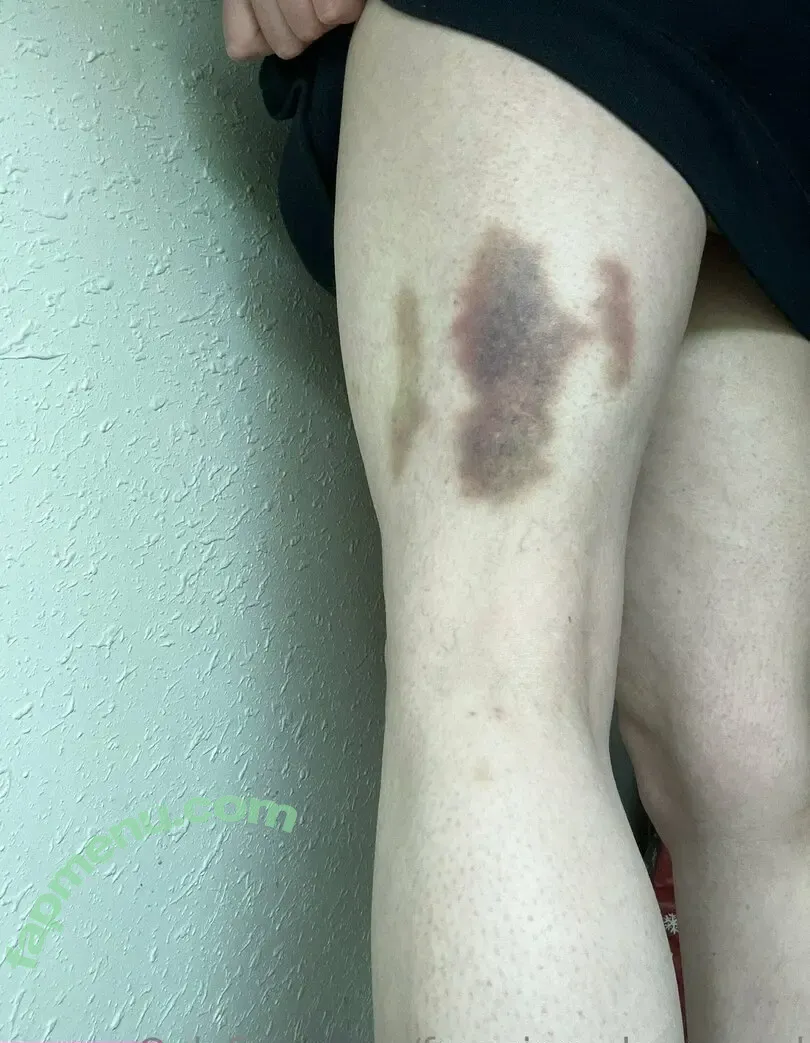 freegingerly_reused nude photo #0027 (freegingerly_reused)