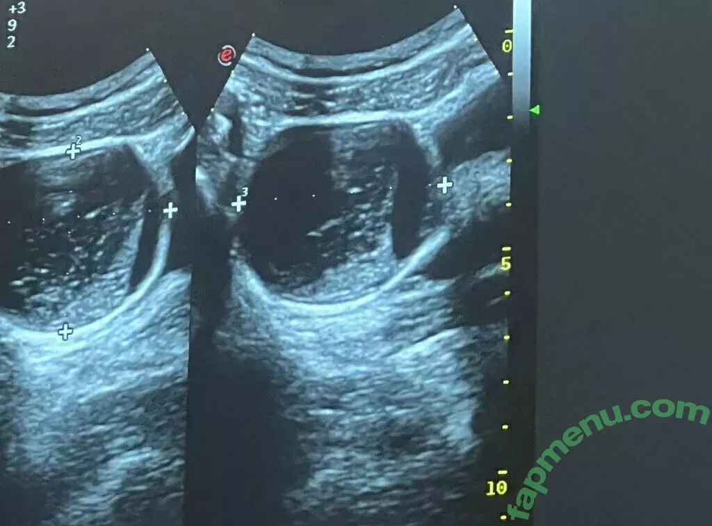 freemollypills nude photo #0182 (freemollypills)