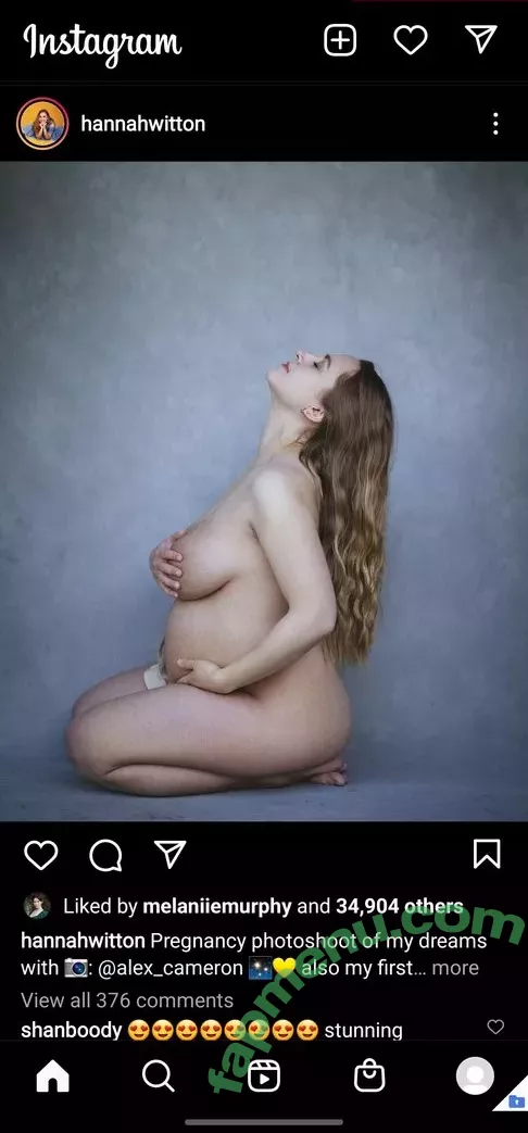 Hannah Witton nude photo #0024 (hannahwitton)