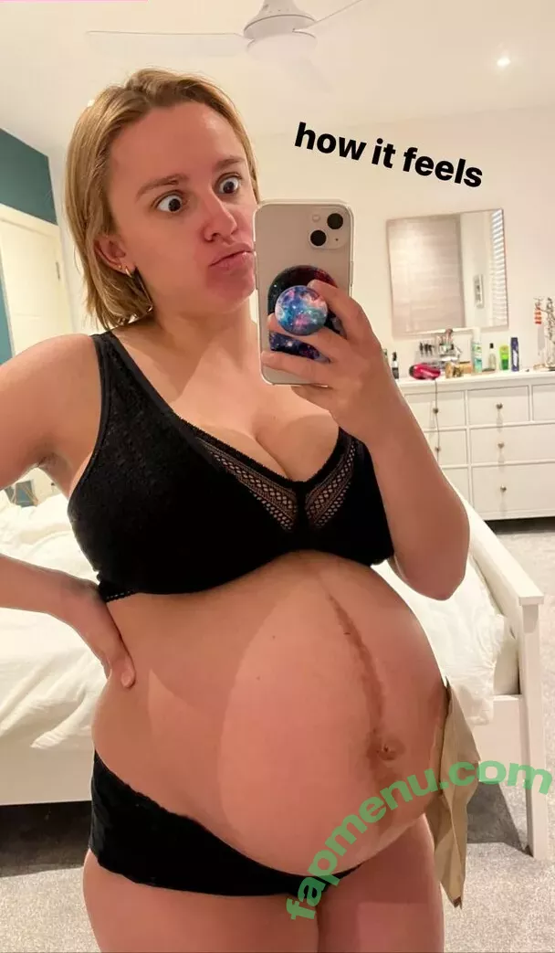 Hannah Witton nude photo #0046 (hannahwitton)