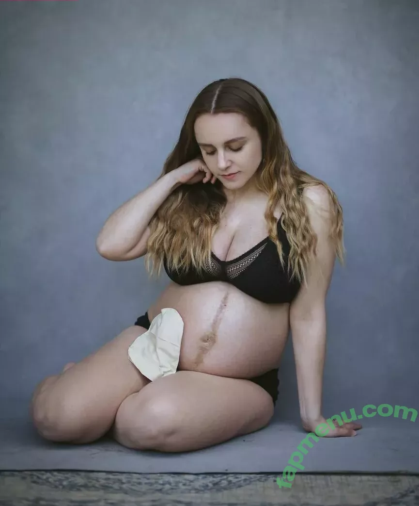 Hannah Witton nude photo #0081 (hannahwitton)