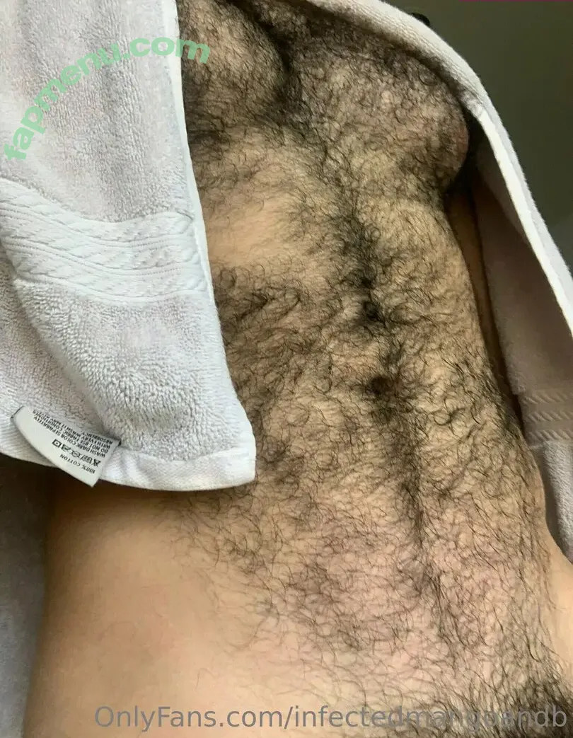 infectedmangoandb nude photo #0035 (infectedmangoandb)