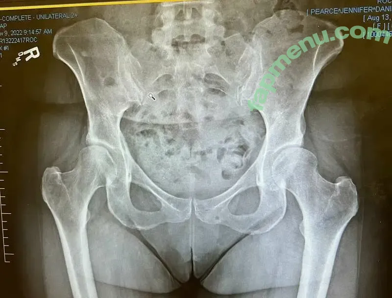 jenniiiiiiii nude photo #0043 (jenni_is_a_whore / jenniiiiii / jenniskinni)