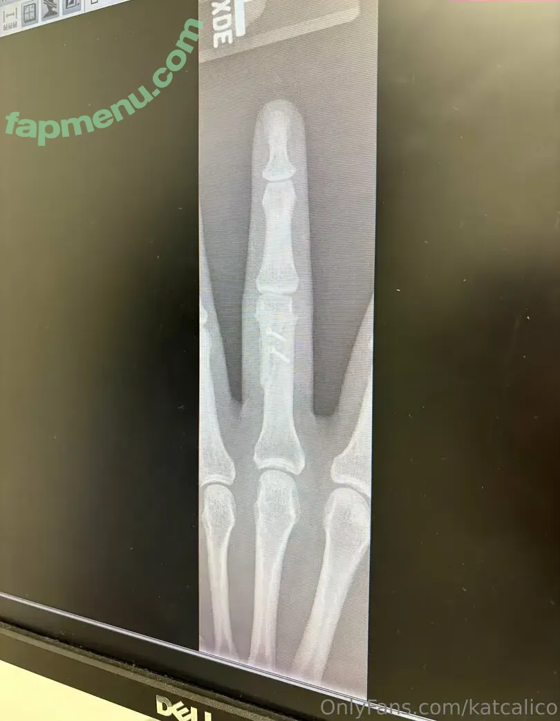 katcalico nude photo #0279 (katcalico)