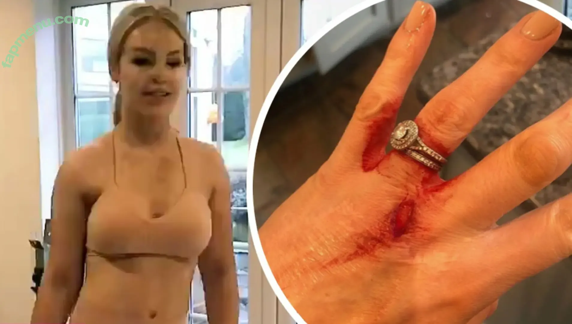 Katie Piper nude photo #0030 (Katie Piper)