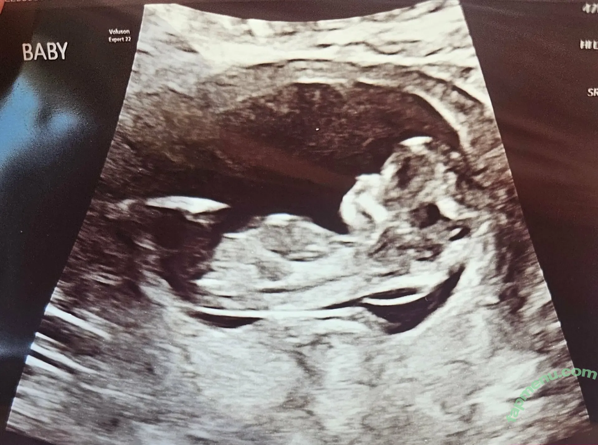 laneydawn240 nude photo #0005 (laneydawn240)