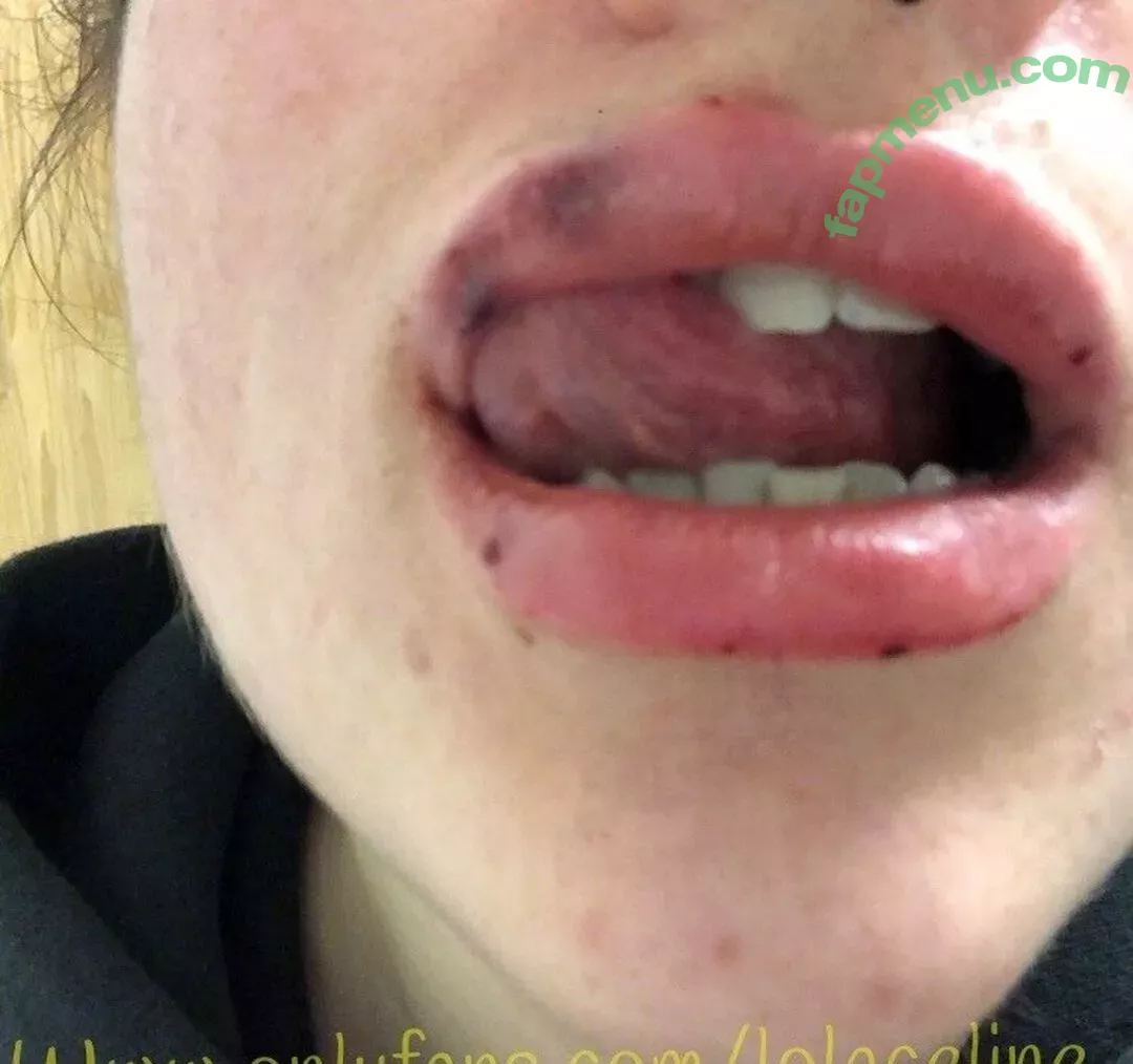 lolaceline nude photo #0039 (lifewithlola20)