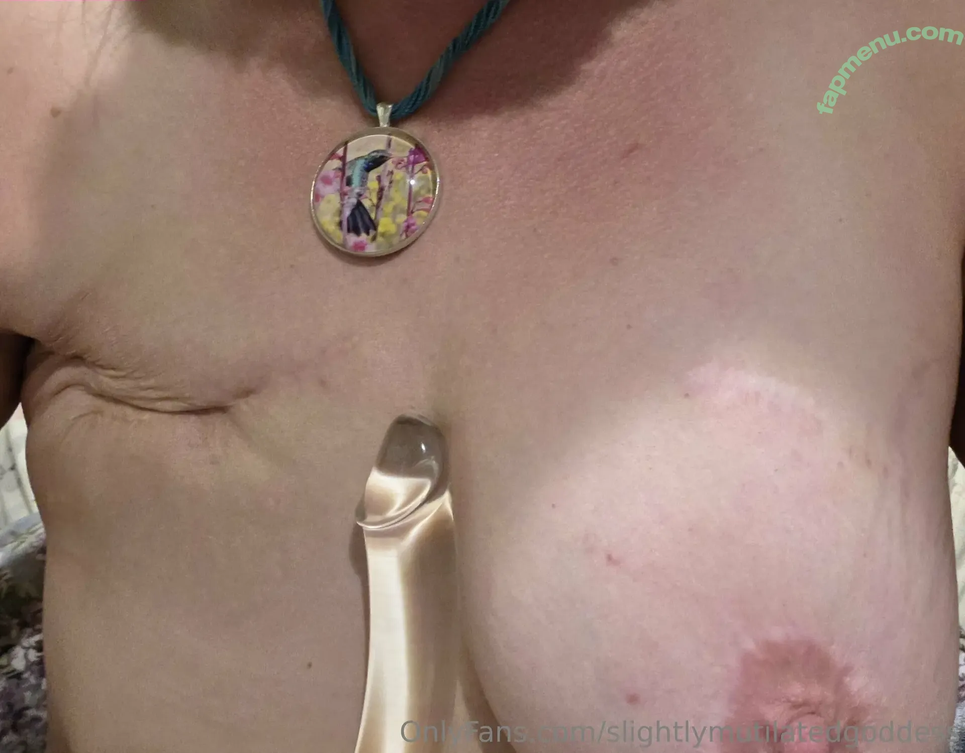 slightlymutilatedgoddess nude photo #0008 (slightly.mutilated.goddess)