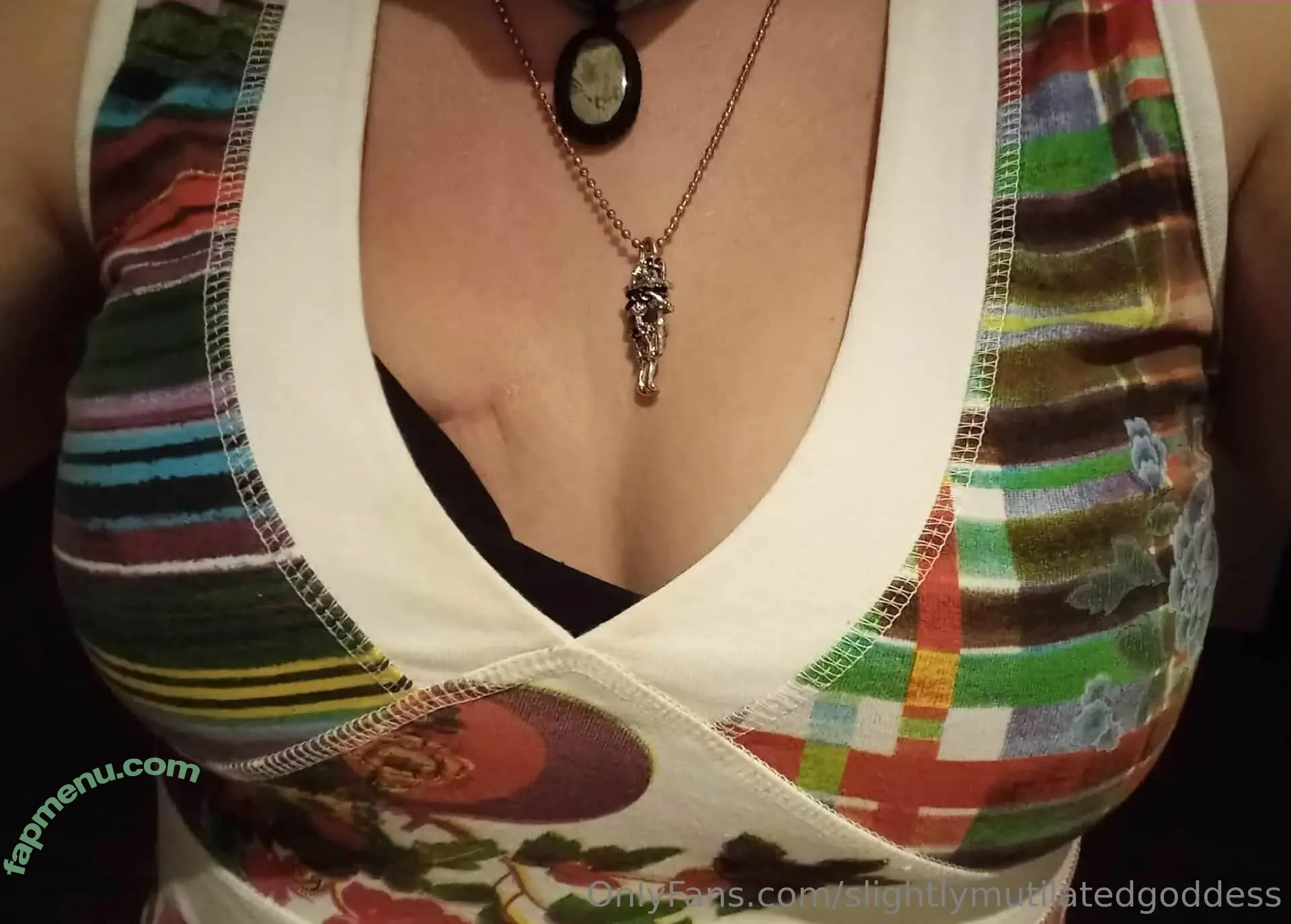 slightlymutilatedgoddess nude photo #0012 (slightly.mutilated.goddess)