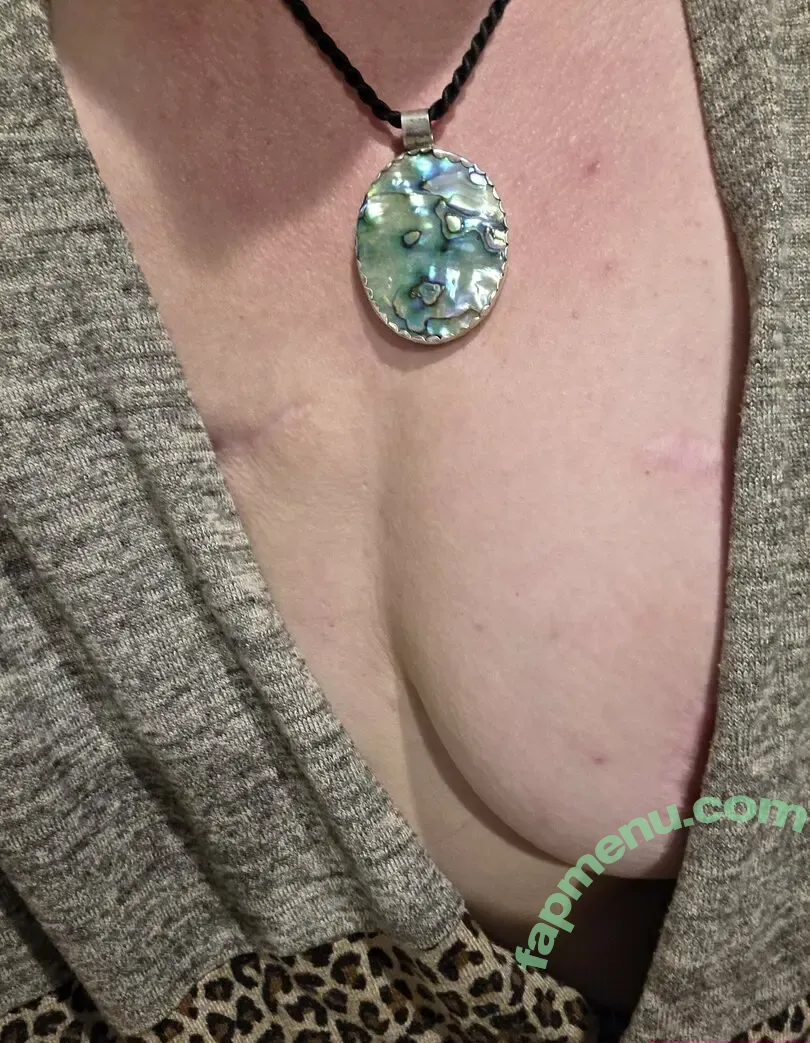 slightlymutilatedgoddess nude photo #0014 (slightly.mutilated.goddess)