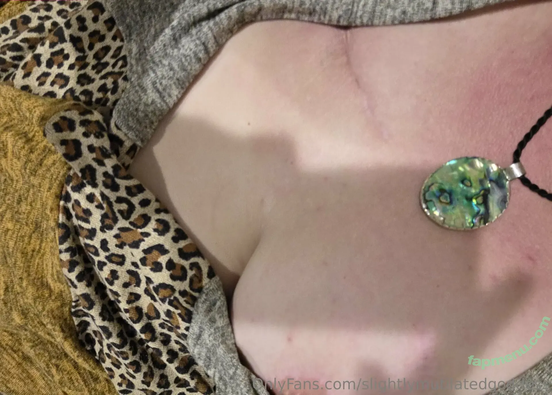 slightlymutilatedgoddess nude photo #0017 (slightly.mutilated.goddess)