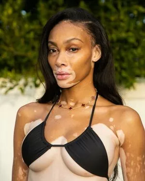 Winnie Harlow / winnieharlow nude photo #0039