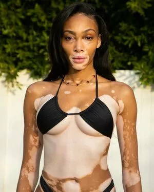 Winnie Harlow / winnieharlow nude photo #0041