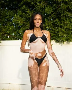 Winnie Harlow / winnieharlow nude photo #0042