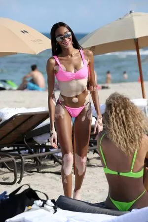 Winnie Harlow / winnieharlow nude photo #0098