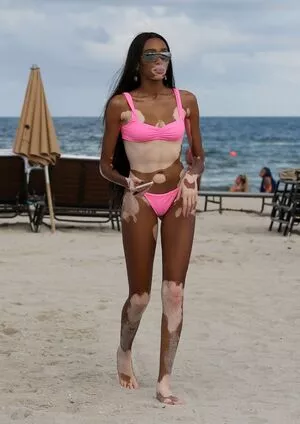 Winnie Harlow / winnieharlow nude photo #0099