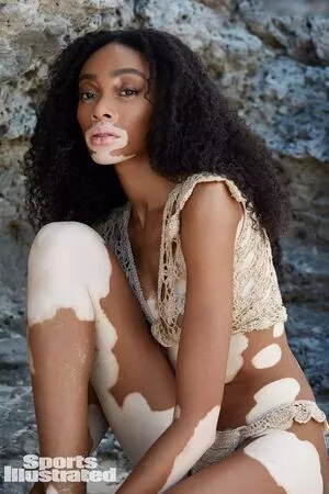 Winnie Harlow / winnieharlow nude photo #0103